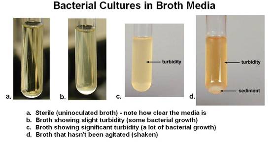 microbiology-liquid-broth-diets-jtpriority